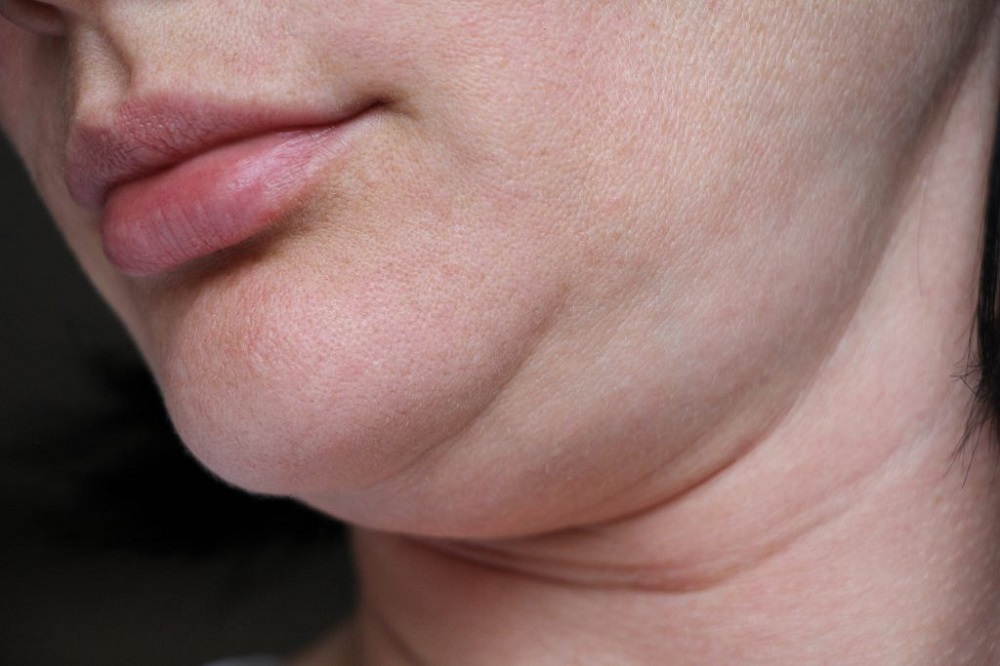 Solve All Your Doubts Regarding Chin Surgery